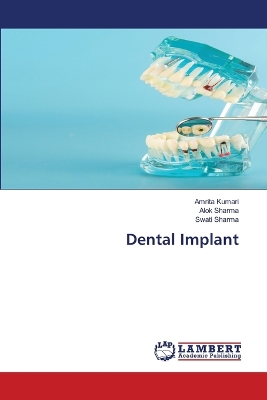 Book cover for Dental Implant