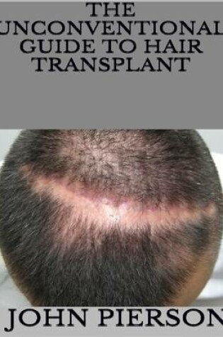 Cover of The Unconventional Guide to Hair Transplant