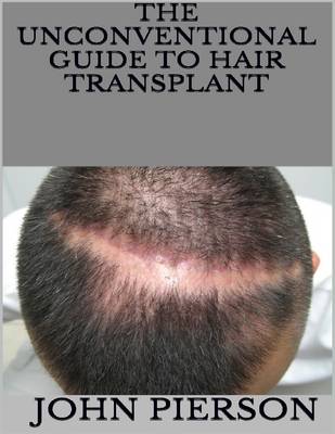 Book cover for The Unconventional Guide to Hair Transplant