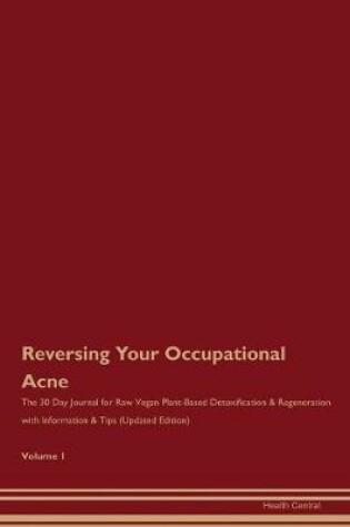 Cover of Reversing Your Occupational Acne