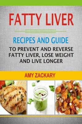 Book cover for Fatty Liver
