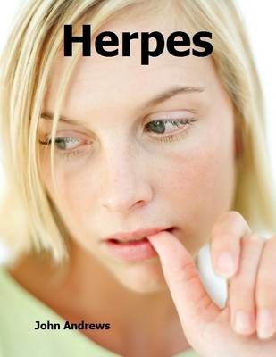 Book cover for Herpes