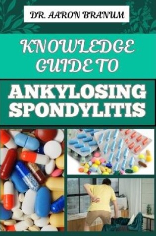 Cover of Knowledge Guide to Ankylosing Spondylitis