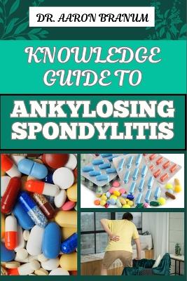 Book cover for Knowledge Guide to Ankylosing Spondylitis