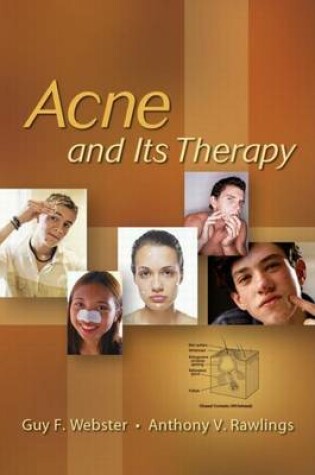 Cover of Acne and Its Therapy
