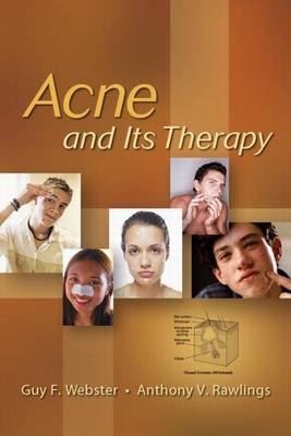 Cover of Acne and Its Therapy