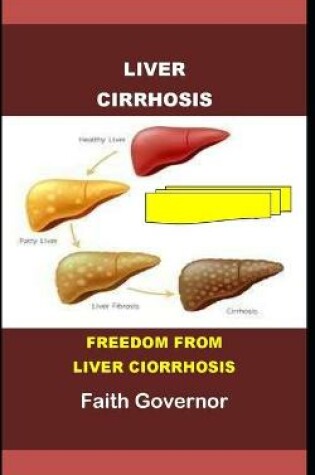 Cover of Liver Cirrhosis