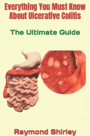 Cover of Everything You Must Know About Ulcerative Colitis