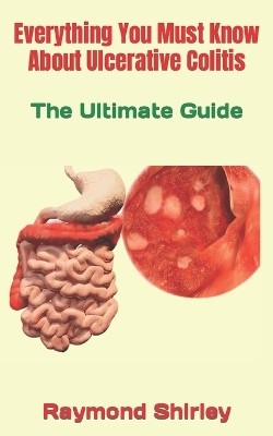 Book cover for Everything You Must Know About Ulcerative Colitis