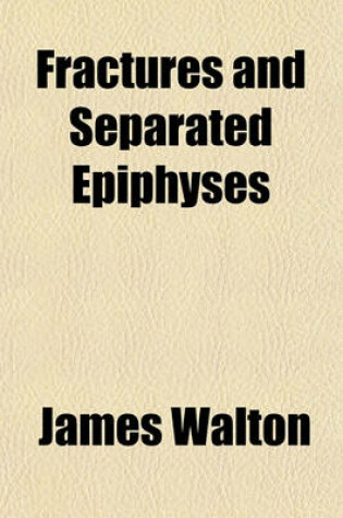Cover of Fractures and Separated Epiphyses