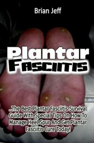 Cover of Plantar Fasciitis
