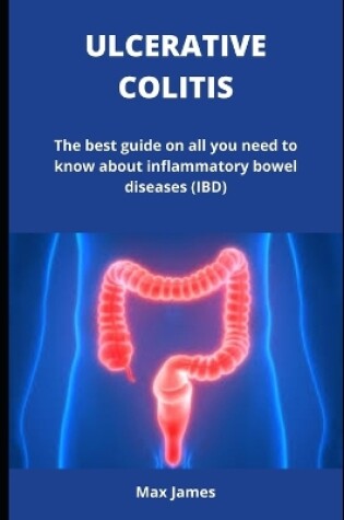 Cover of Ulcerative Colitis