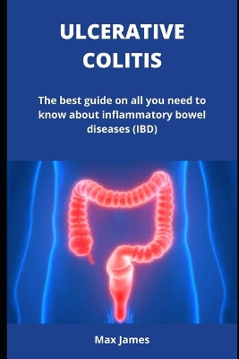 Book cover for Ulcerative Colitis