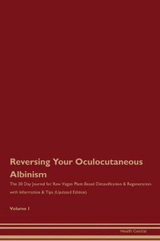 Cover of Reversing Your Oculocutaneous Albinism