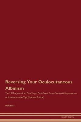 Book cover for Reversing Your Oculocutaneous Albinism