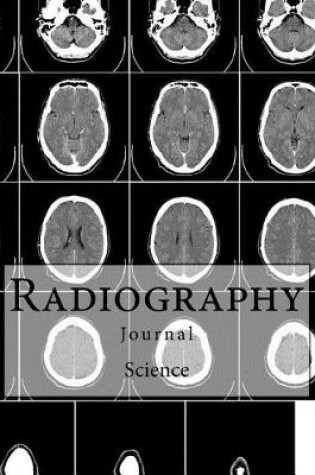 Cover of Radiography Journal