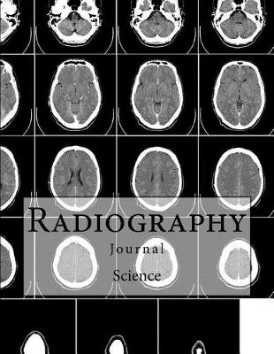 Cover of Radiography Journal