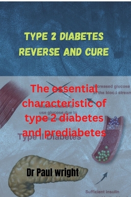 Book cover for Type 2 diabetes reverse and cure