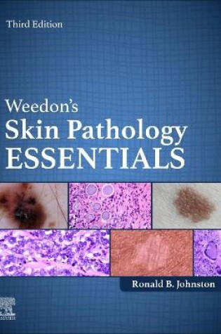 Cover of Weedon's Skin Pathology Essentials - E-Book