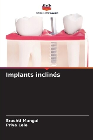 Cover of Implants inclin�s