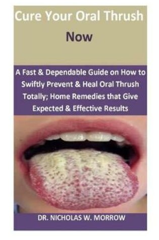 Cover of Cure Your Oral Thrush Now