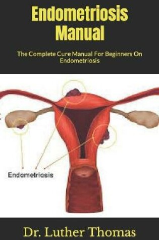 Cover of Endometriosis Manual