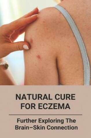 Cover of Natural Cure For Eczema