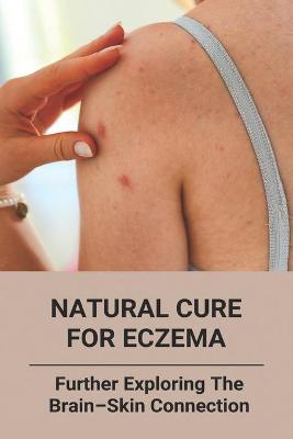 Book cover for Natural Cure For Eczema