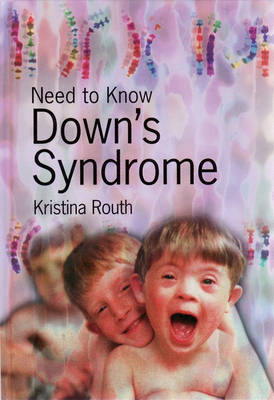 Cover of Downs Syndrome