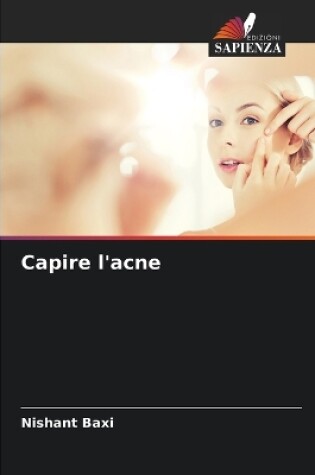 Cover of Capire l'acne