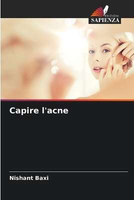 Book cover for Capire l'acne