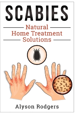 Book cover for Scabies Natural Home Treatment Solution