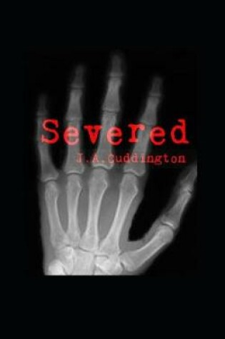 Cover of Severed