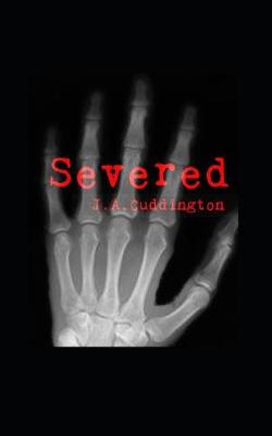 Book cover for Severed