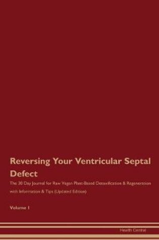 Cover of Reversing Your Ventricular Septal Defect