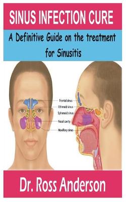 Book cover for Sinus Infection Cure