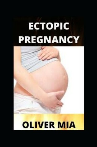 Cover of Ectopic Pregnancy