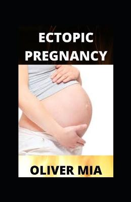 Book cover for Ectopic Pregnancy