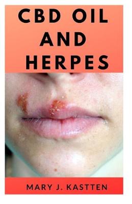 Book cover for CBD Oil and Herpes