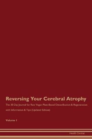 Cover of Reversing Your Cerebral Atrophy