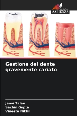 Book cover for Gestione del dente gravemente cariato