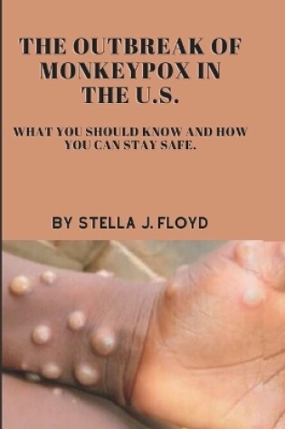 Cover of The outbreak of monkeypox in the U.S