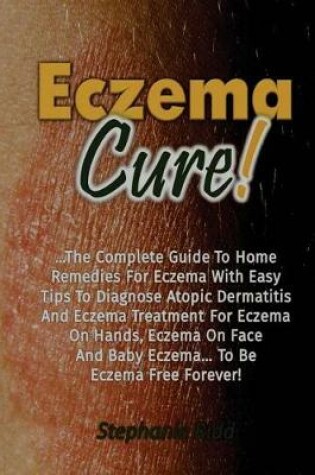 Cover of Eczema Cure!