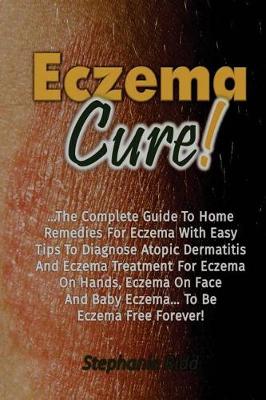 Book cover for Eczema Cure!