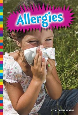 Cover of Allergies