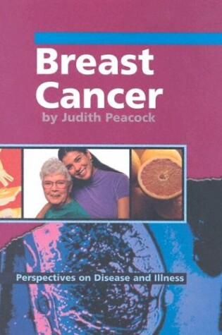 Cover of Breast Cancer (Perspec. Diseas