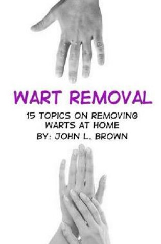 Cover of Wart Removal