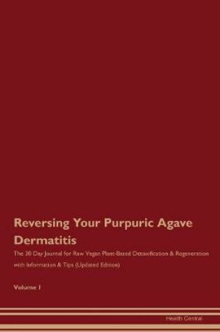 Cover of Reversing Your Purpuric Agave Dermatitis