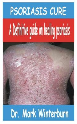 Book cover for Psoriasis Cure