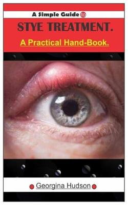 Cover of A Simple Guide To STYE TREATMENT.